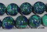 CTU1819 15.5 inches 20mm round synthetic turquoise beads